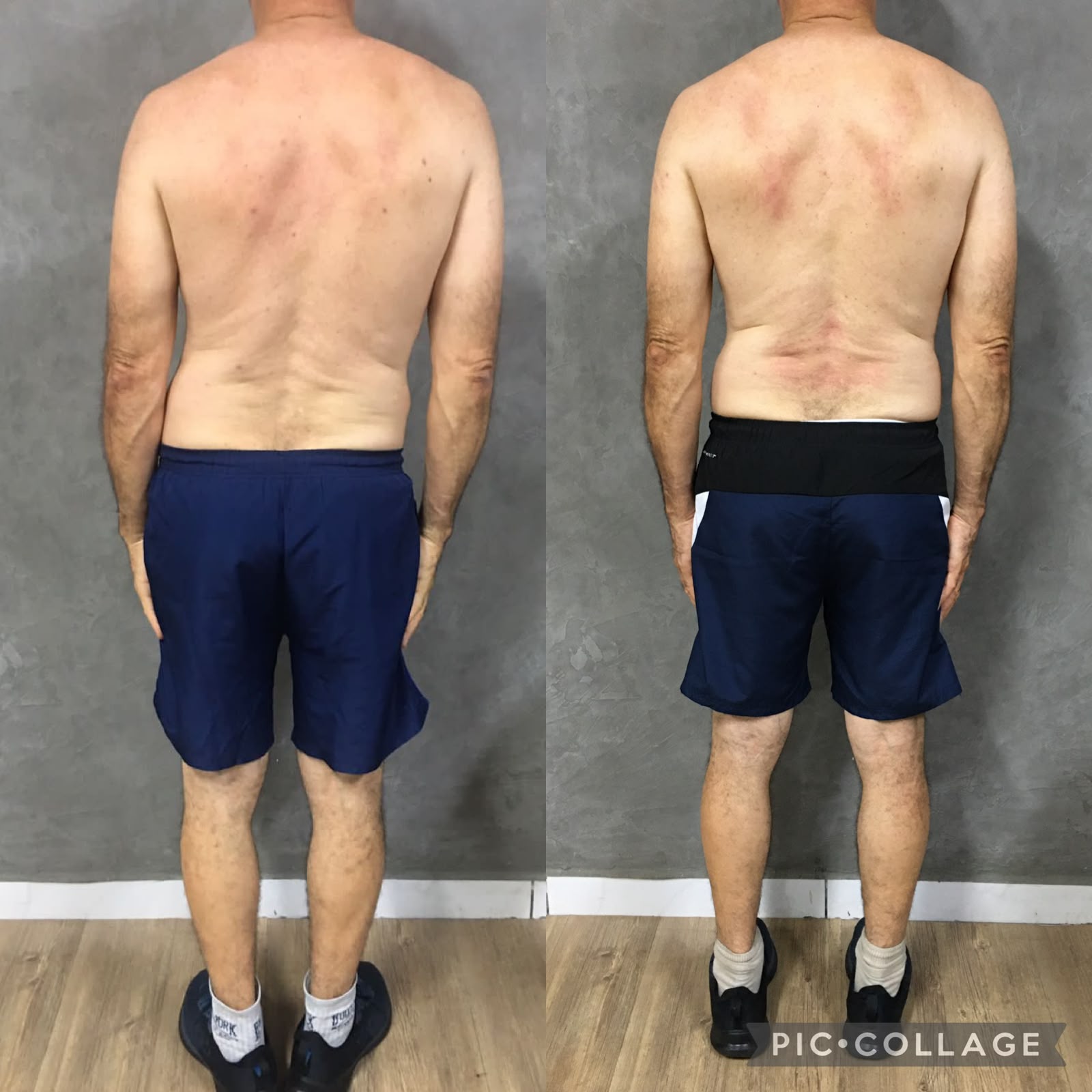 Evolução postural de aluno do LD Studio